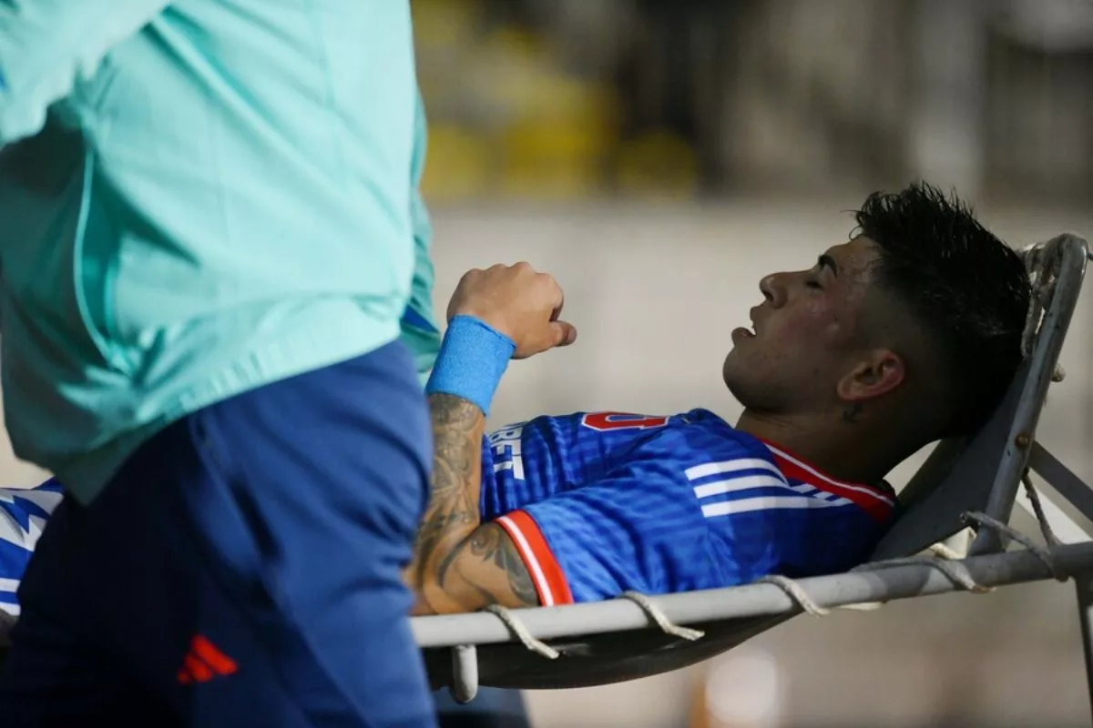 Recuperándose: Así está el rostro de Maxi Guerrero tras el fuerte golpe en el Clásico Universitario