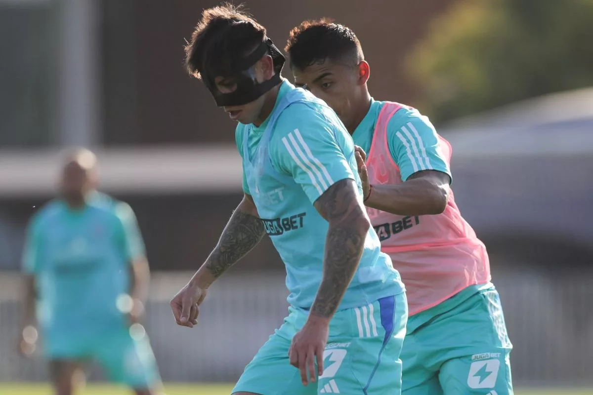 Recuperándose: Así está el rostro de Maxi Guerrero tras el fuerte golpe en el Clásico Universitario