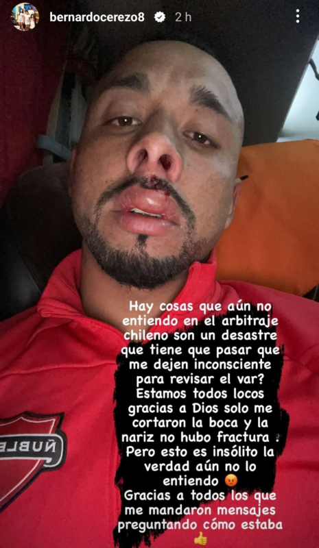 Jugador de la U le pegó en la cara y terminó enfurecido con el arbitraje: "Son un desastre"